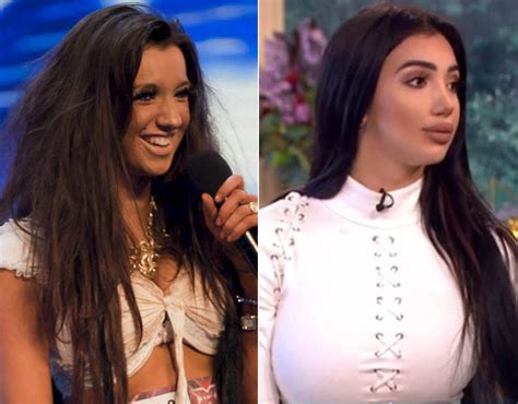 chloe khan x factor|chloe khan before surgery.